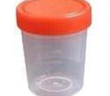 Sputum container